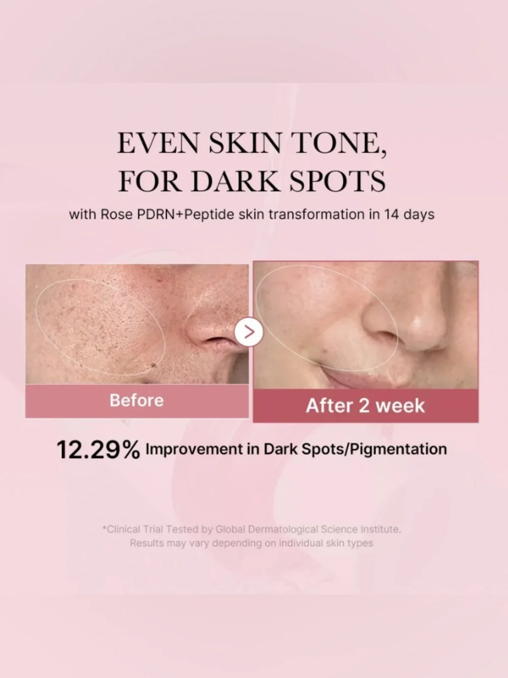 Medicube PDRN Pink Cica Soothing Toner